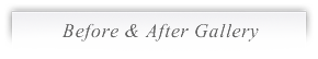 Before & After Gallery